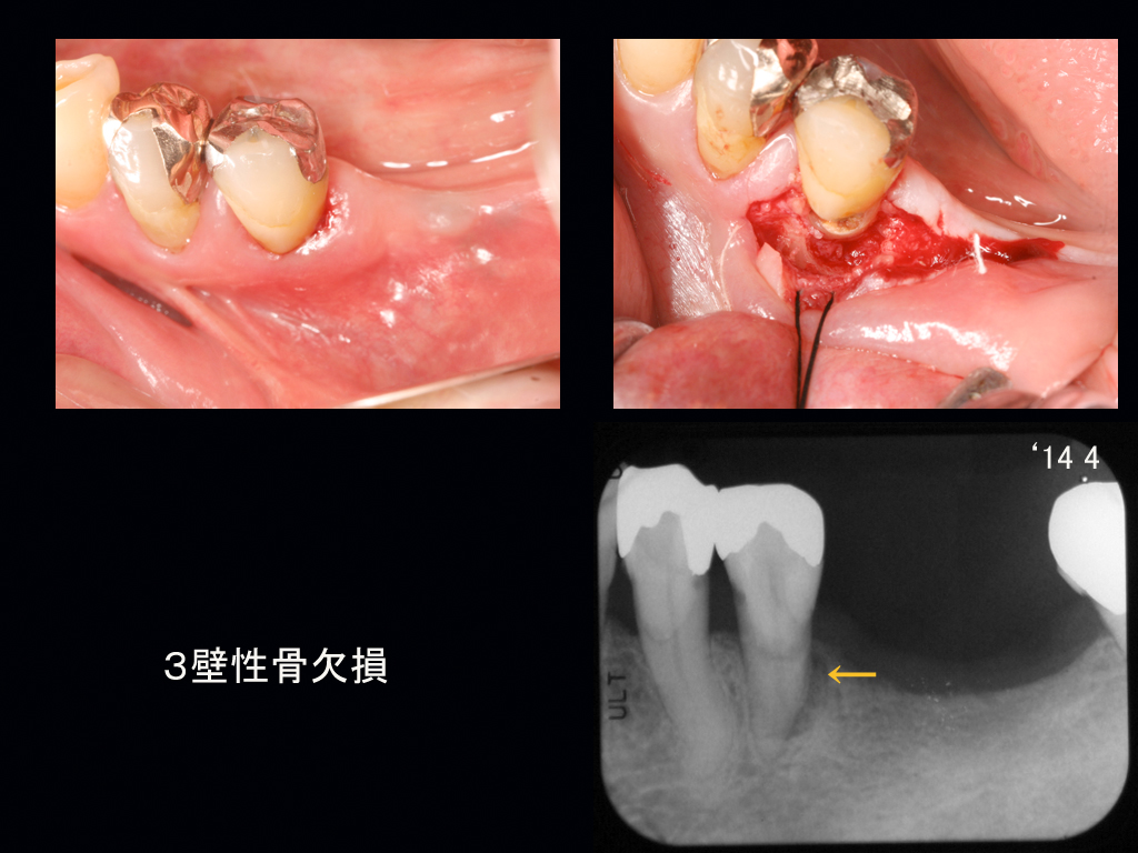 http://www.makino418.com/blog/2014/05/29/Kr%20N%EF%BC%96.jpg