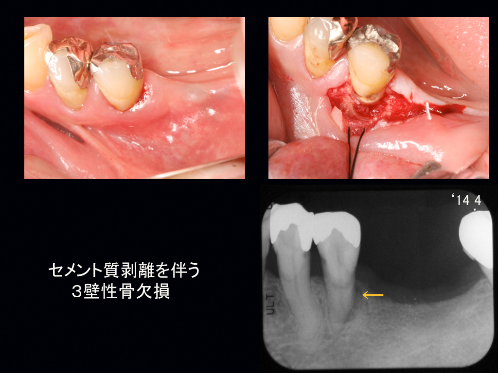 http://www.makino418.com/blog/2014/05/29/Kr%E3%80%80n%EF%BC%96.jpg