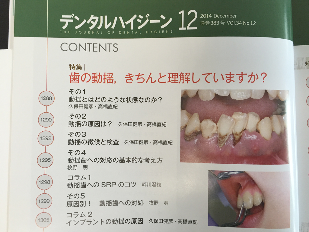 http://www.makino418.com/blog/2014/11/20/%E3%81%A7%E3%82%93%E3%81%9F%E3%82%8B%E3%81%AF%E3%81%84%E3%81%98%E3%83%BC%E3%82%93.jpg