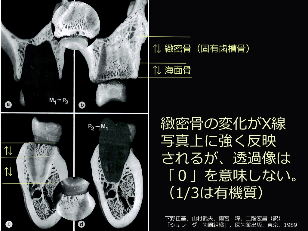 http://www.makino418.com/blog/2015/02/08/%E9%80%8F%E9%81%8E%E5%83%8F%EF%BC%90%E3%81%AF%EF%BC%9F.jpg