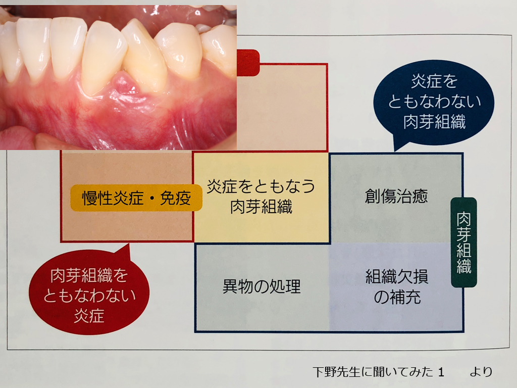 http://www.makino418.com/blog/2018/07/09/%E8%82%89%E8%8A%BD%E7%B5%84%E7%B9%94%EF%BC%91.jpg