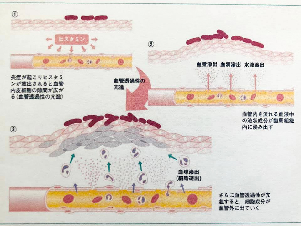 http://www.makino418.com/blog/2019/09/28/%E6%BF%A1%E3%82%8C%E3%81%9F%E6%AD%AF%E8%82%89.jpg