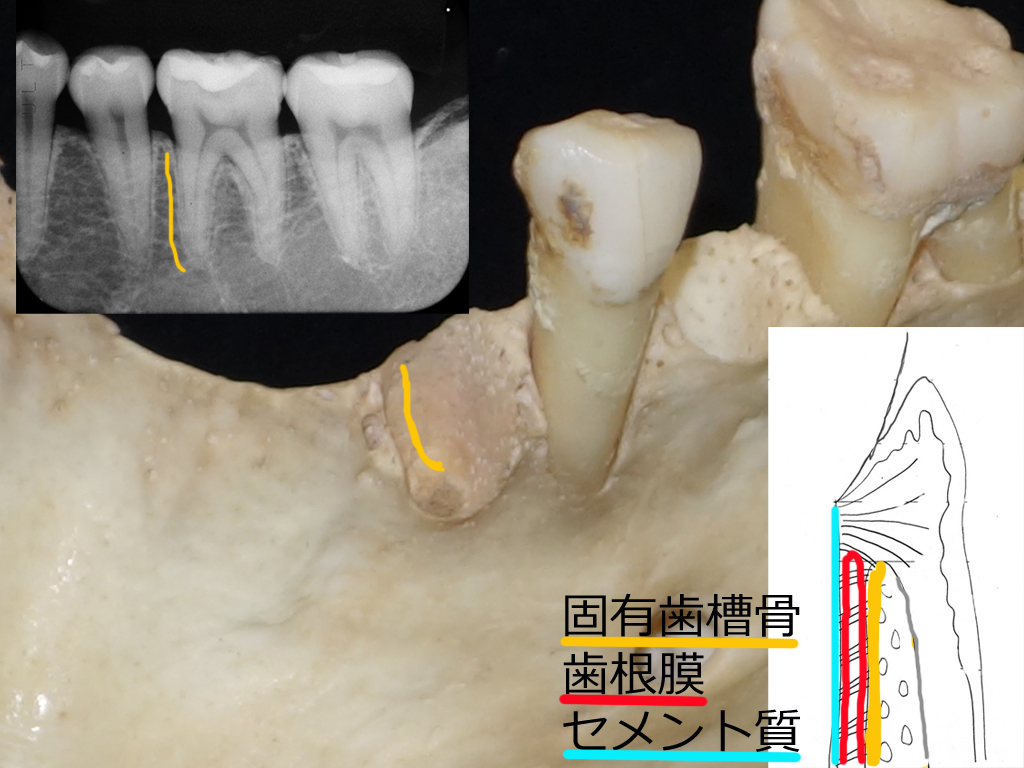 http://www.makino418.com/blog/2020/01/22/%E5%9B%BA%E6%9C%89%E6%AD%AF%E6%A7%BD%E9%AA%A81.5.jpg