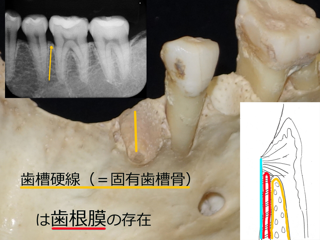 http://www.makino418.com/blog/2020/01/25/%E5%9B%BA%E6%9C%89%E6%AD%AF%E6%A7%BD%E9%AA%A81.6%E8%AA%A4.jpg