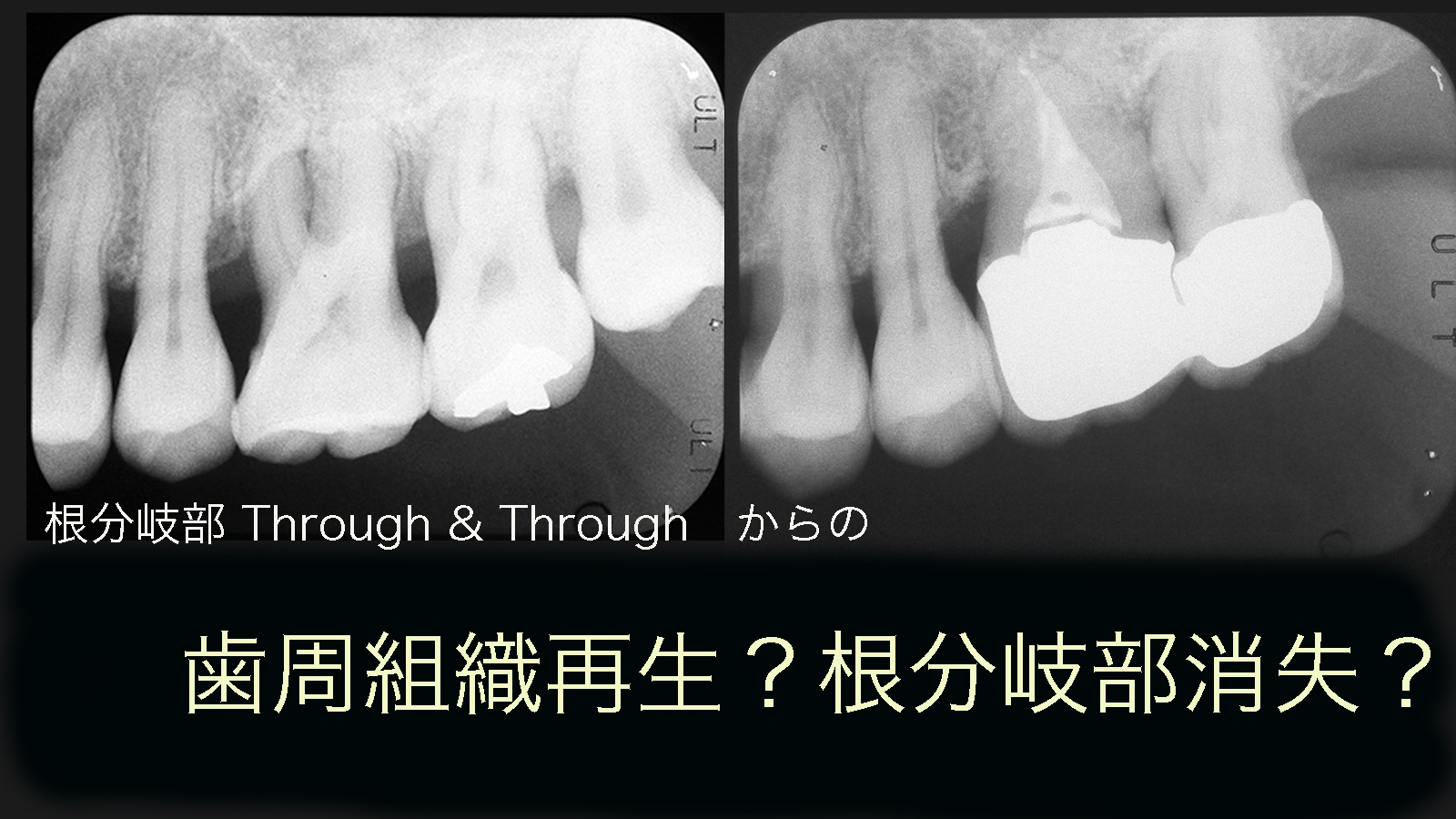 https://www.makino418.com/blog/%E5%86%8D%E7%94%9F%E3%81%8B%EF%BC%9F%E6%B6%88%E5%A4%B1%E3%81%8B%EF%BC%9F.jpg