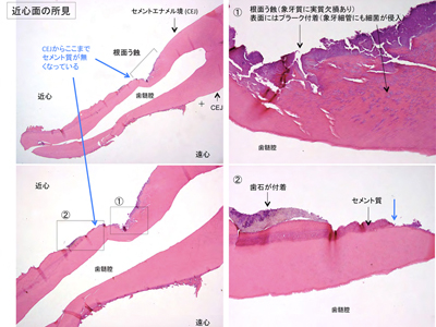 病理切片の解説.jpg