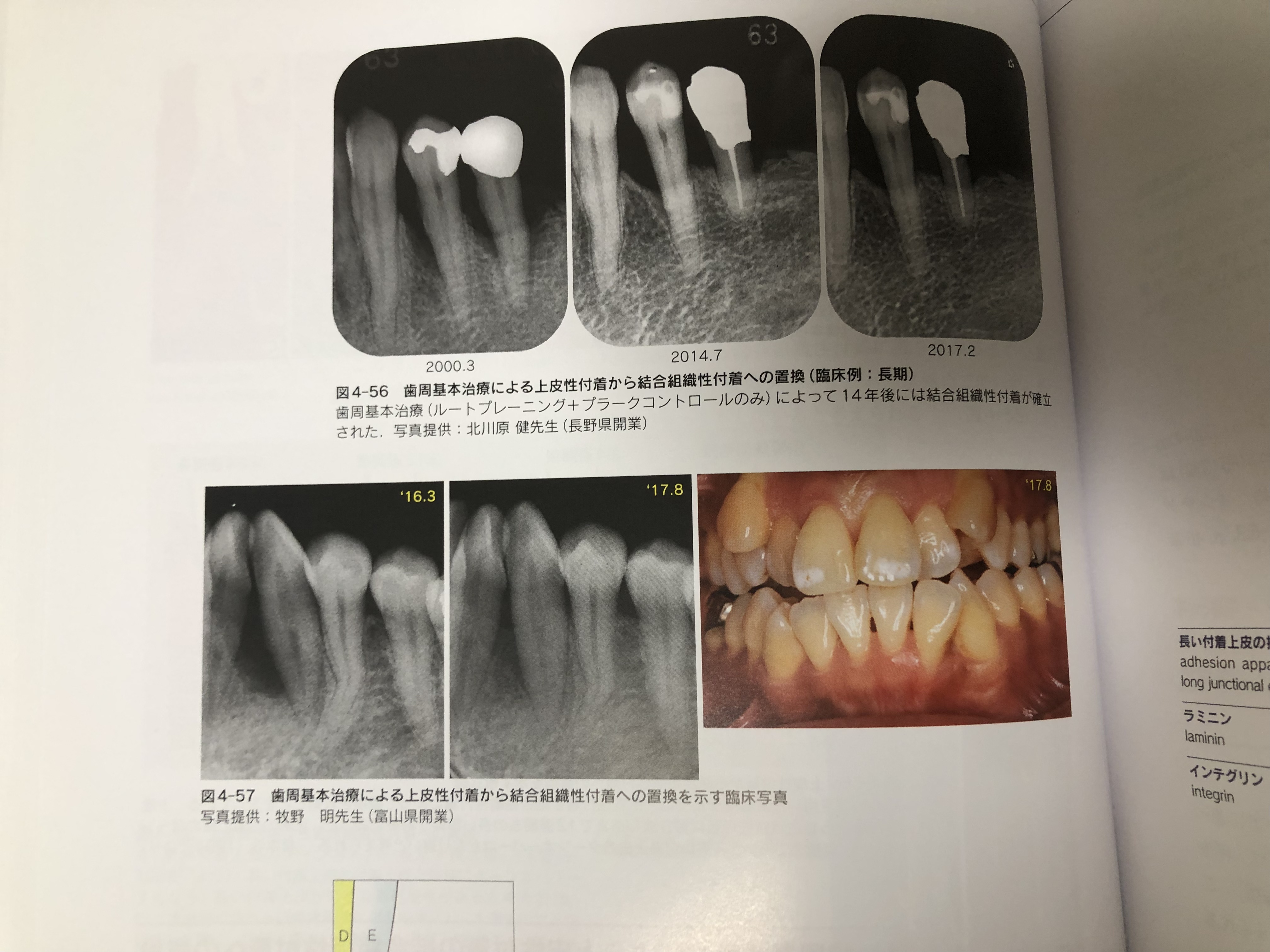 https://www.makino418.com/blog/2022/07/30/F3B1E3D2-45F7-4893-8DCE-2B5733FFCEEE.jpeg