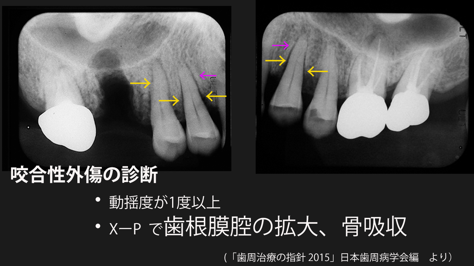 https://www.makino418.com/blog/2023/11/07/%EF%BC%91%EF%BC%81.jpg