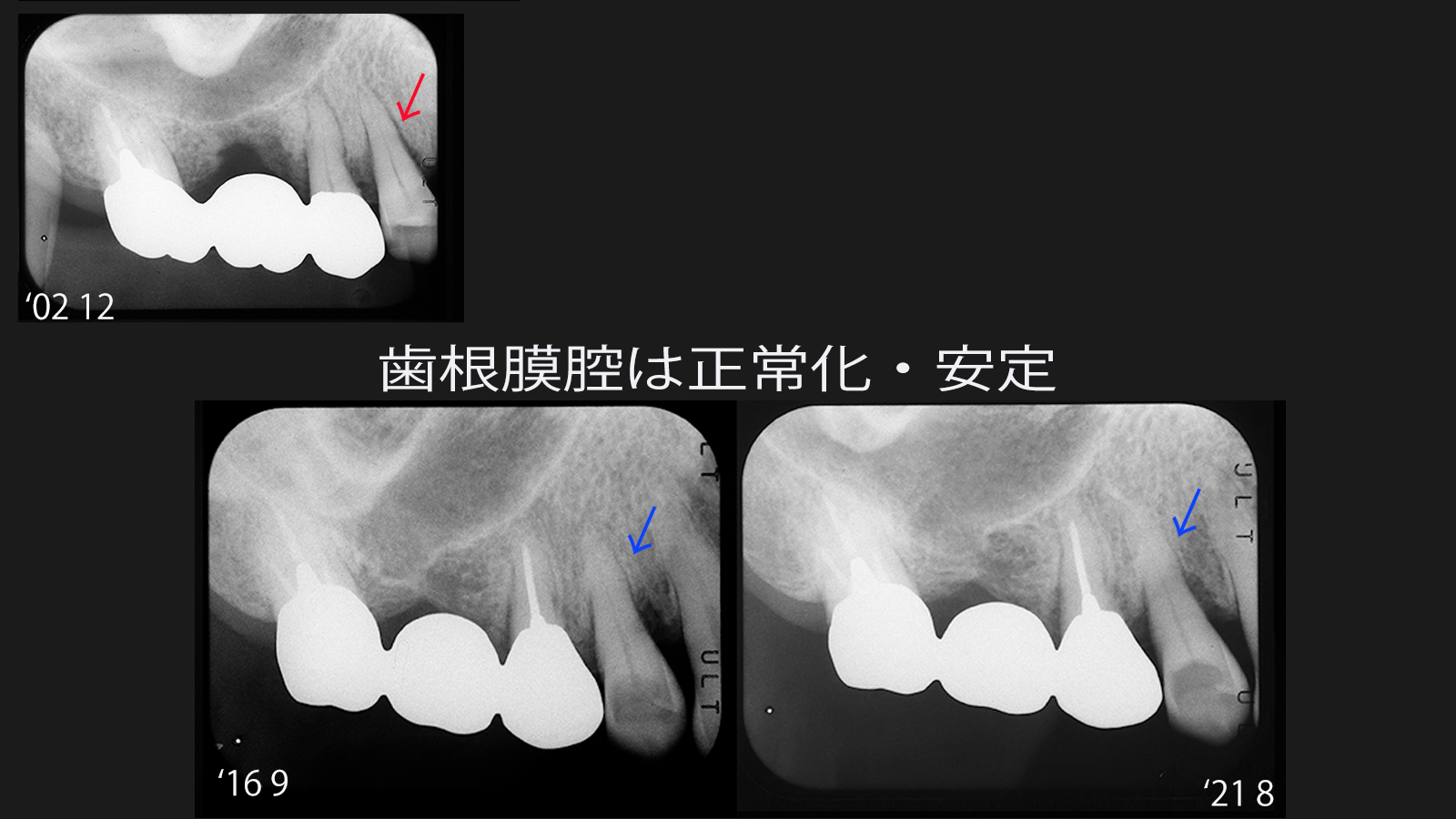 https://www.makino418.com/blog/2023/11/07/2%21.jpg