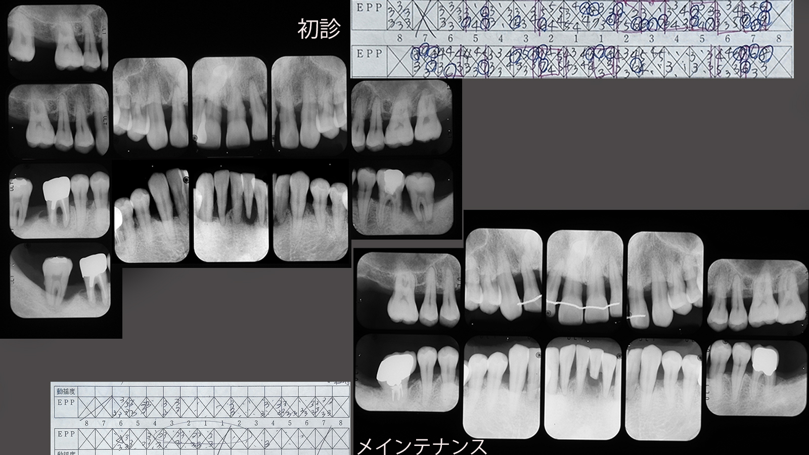 https://www.makino418.com/blog/2025/01/23/%E5%88%9D%E8%A8%BA%E3%80%9C%E3%83%A1%E3%83%B3%E3%83%86X-P.jpg