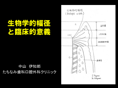 BW%E2%80%99%EF%BC%90%EF%BC%99.jpg