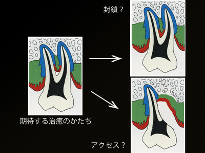 白黒反転.jpgのサムネール画像