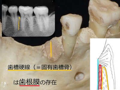 固有歯槽骨1.6.jpg