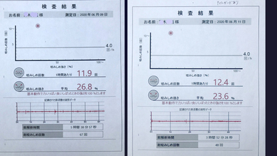 筋電計結果.jpg