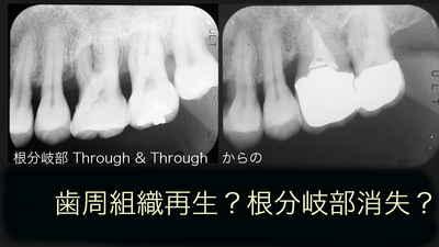 再生か？消失か？.jpg