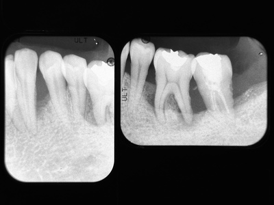 Ｘ線像アーカイブ 院長ブログ - まきの歯科医院 | 富山県高岡市