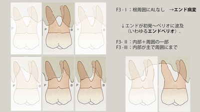 F3-エンドペリオ.jpg