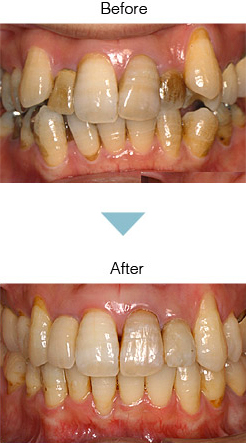 PMTC Before After